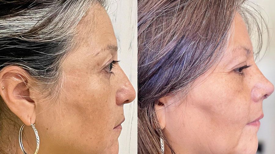 Dr. Fernando Vázquez - NARIZ