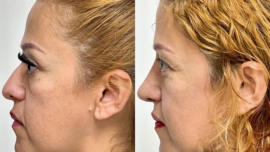 Dr. Fernando Vázquez - OIDOS