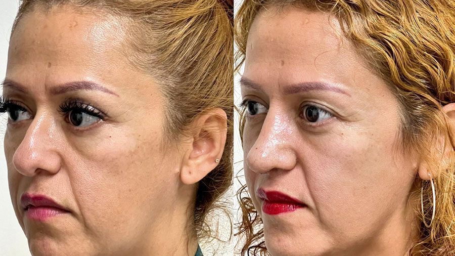 Dr. Fernando Vázquez - ENDOSCOPIA