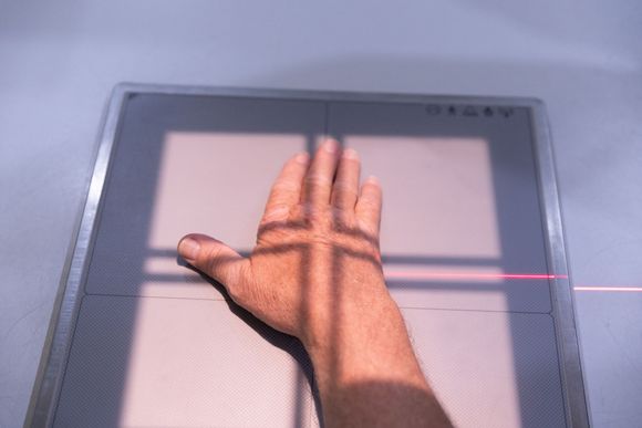 A person is laying on a table with a laser shining on their leg.