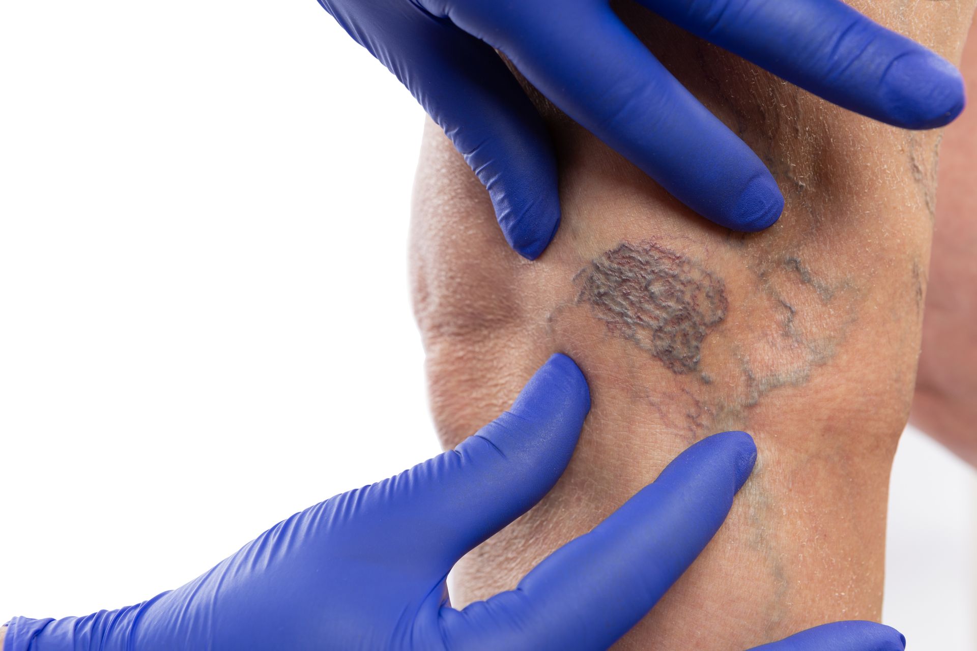 HAUTKREBSVORSORGE & MUTTERMALKONTROLLE, Hautarzt Dr.med.univ. Michael Skoll, 1110 Wien