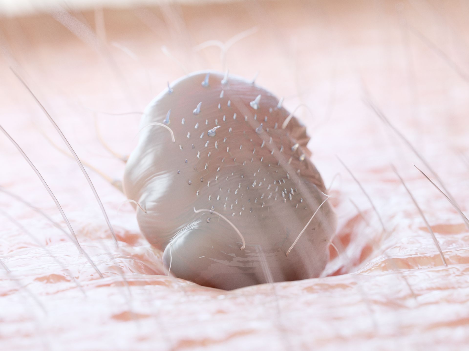 Krätze (Skabies), Hautarzt Dr.med.univ. Michael Skoll