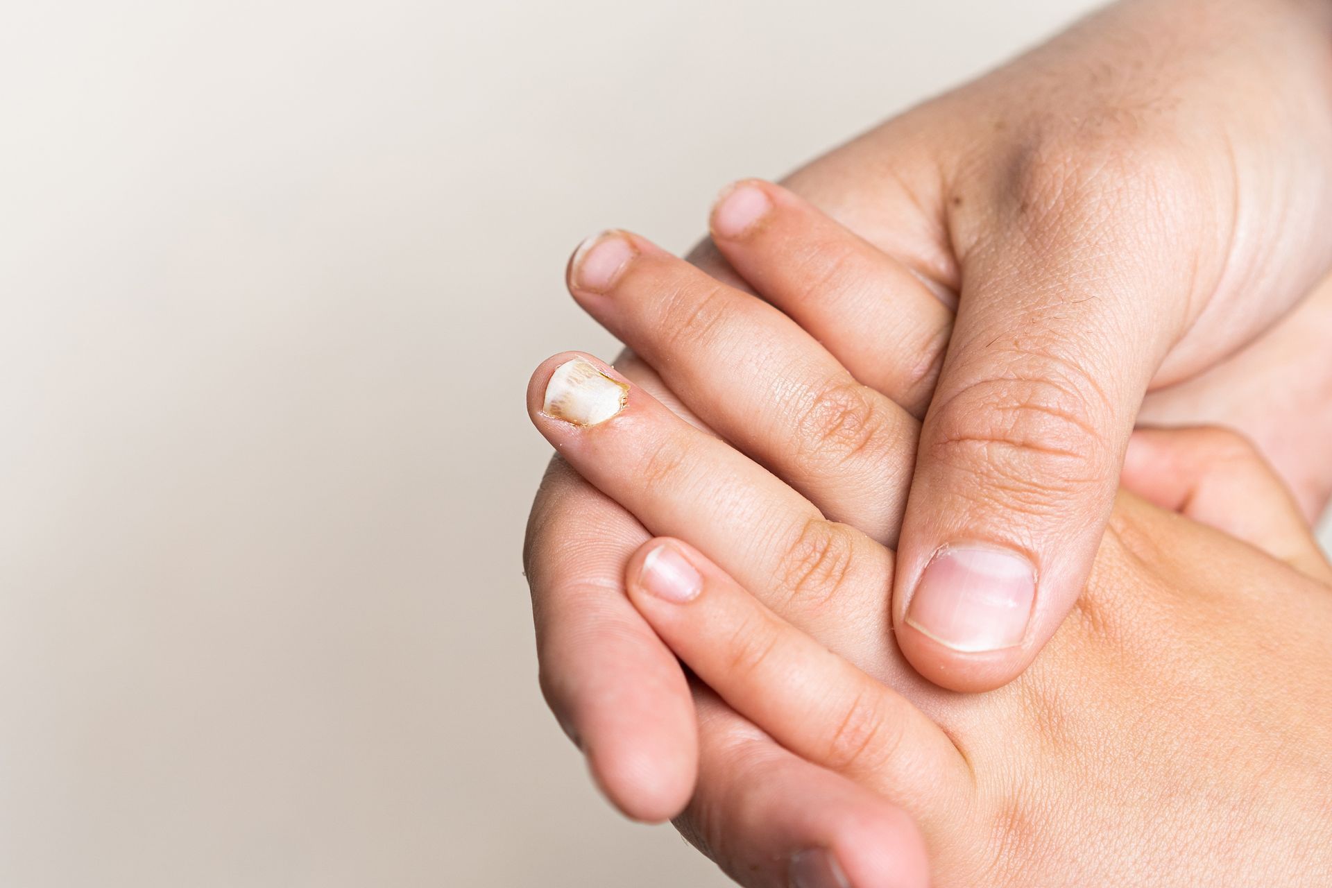 Nagelpilz, Hautarzt Dr.med.univ. Michael Skoll