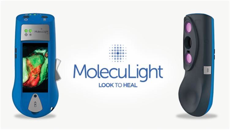 https://us.moleculight.com/