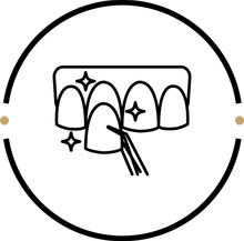 An illustration of teeth with a dental veneer.