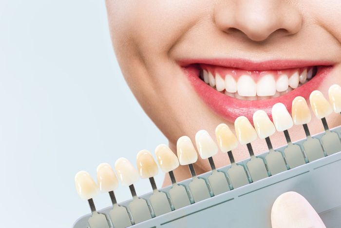 Matching a smiling woman’s teeth to her veneers using a cosmetic dentistry shade guide.]