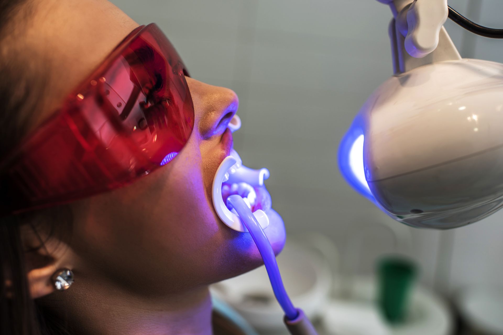 Young woman whitening teeth with medical laser at dentist’s office, close-up shot. 