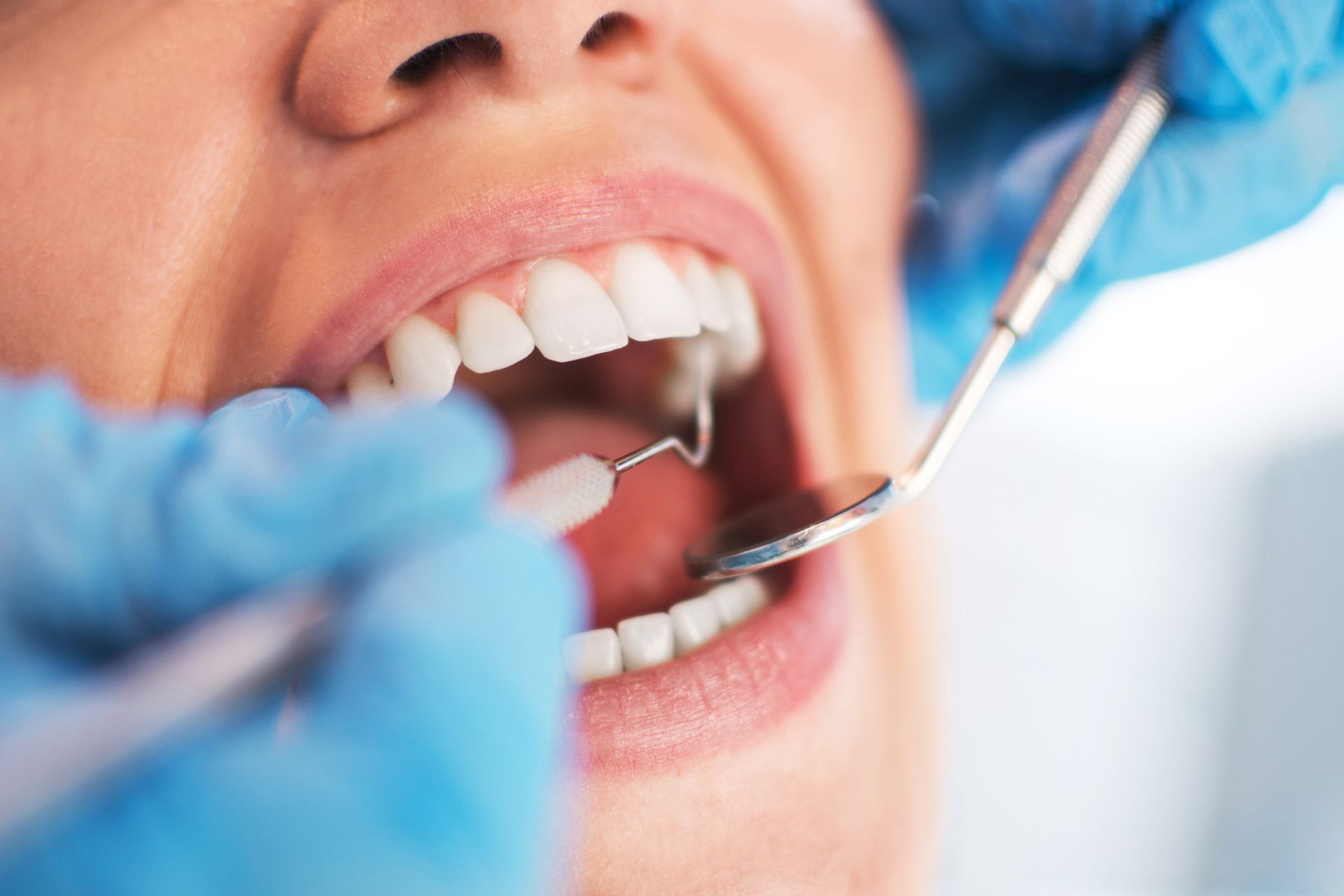 An open patient's mouth during an oral checkup at the dentist.