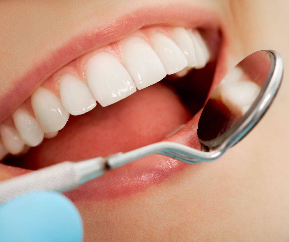 Gums Care — Patient's Healthy Gums and Teeth in Sarasota, FL
