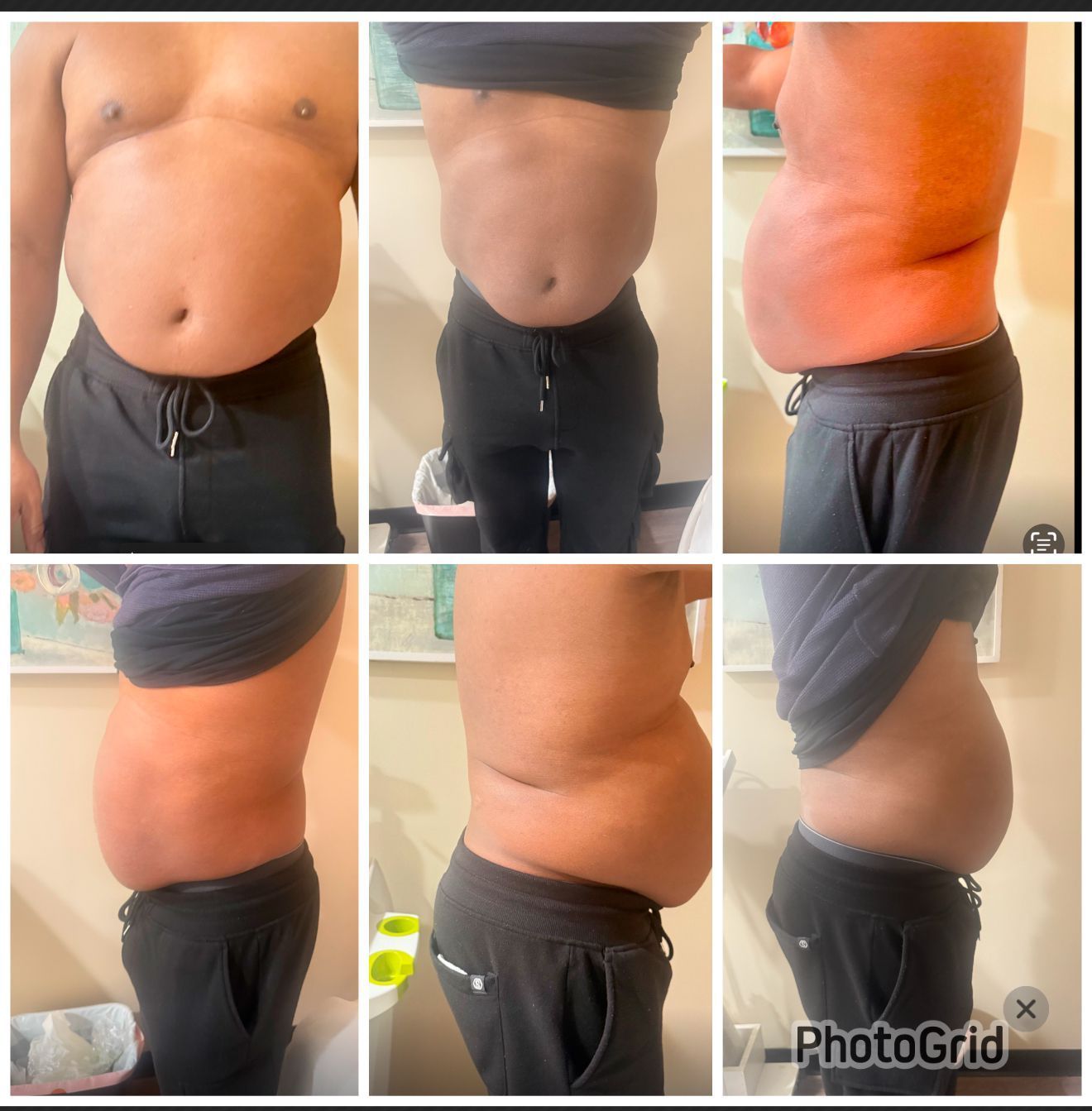 A man 's belly is shown in a photo grid. Before and after photos.