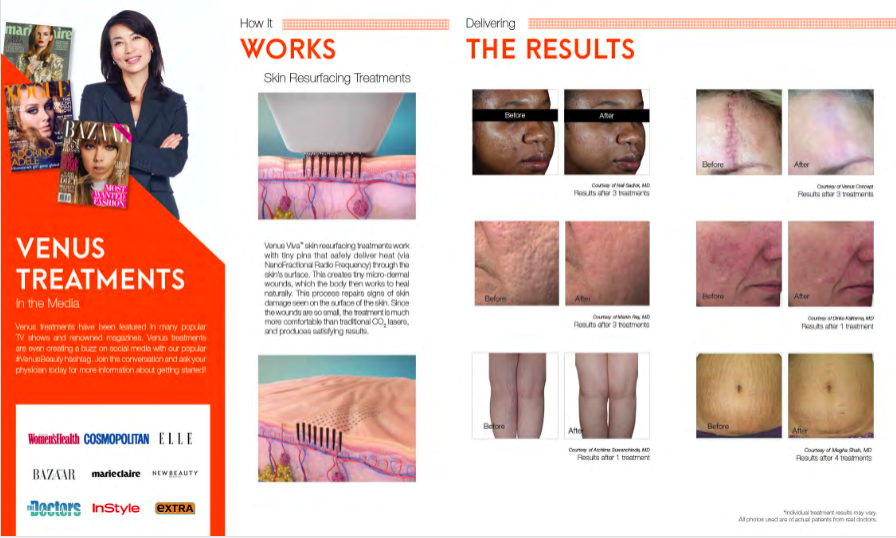 Venus treatment magazine