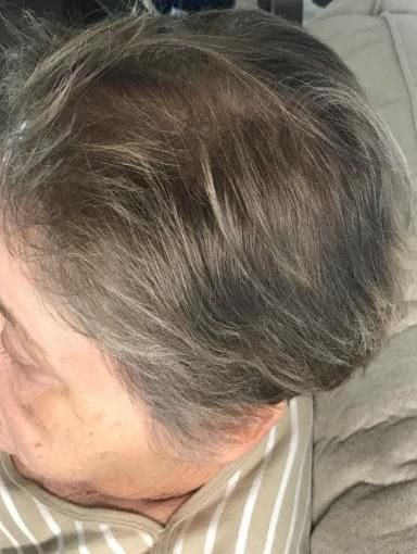 A woman with gray hair is laying on a couch