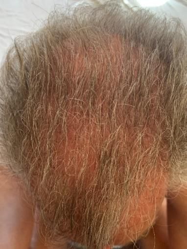 A close up of a man 's head with a lot of hair