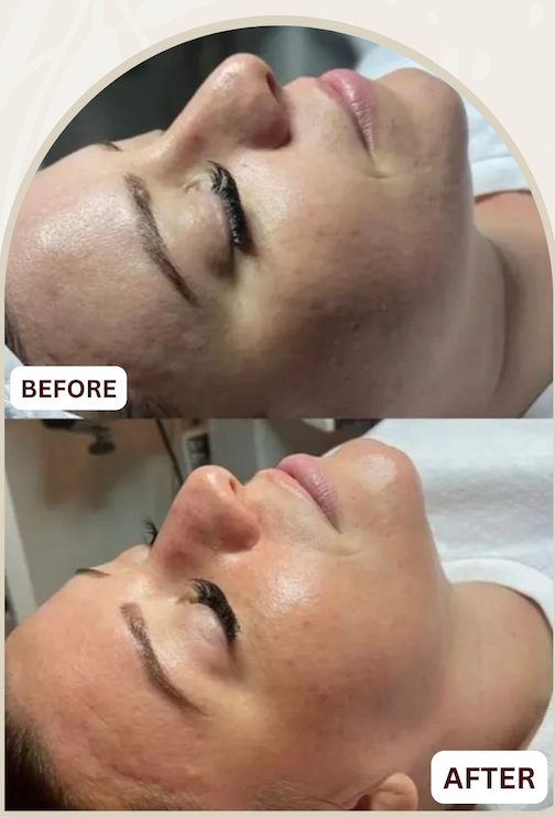 Before and after treatment