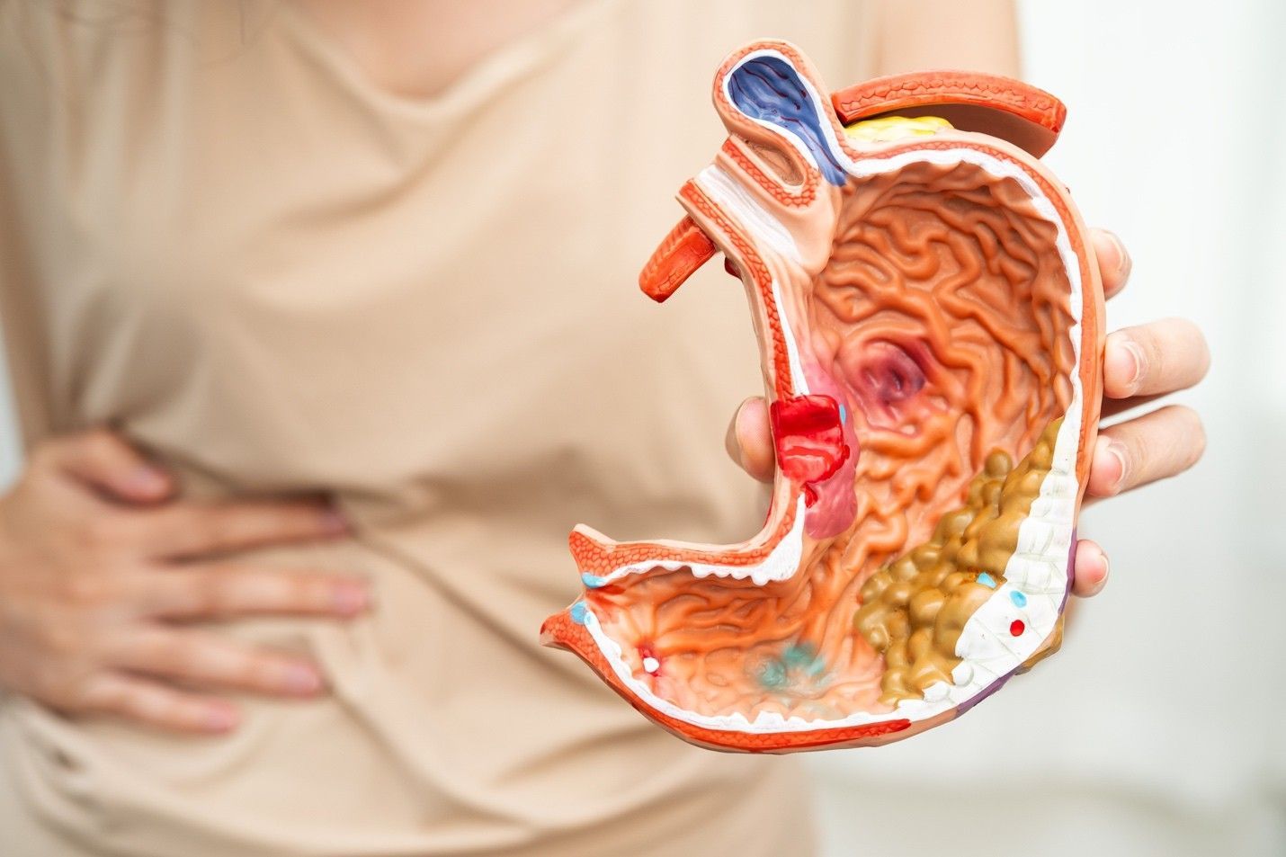 Leaky Gut Syndrome: Myth or Medical Condition? | Northlake