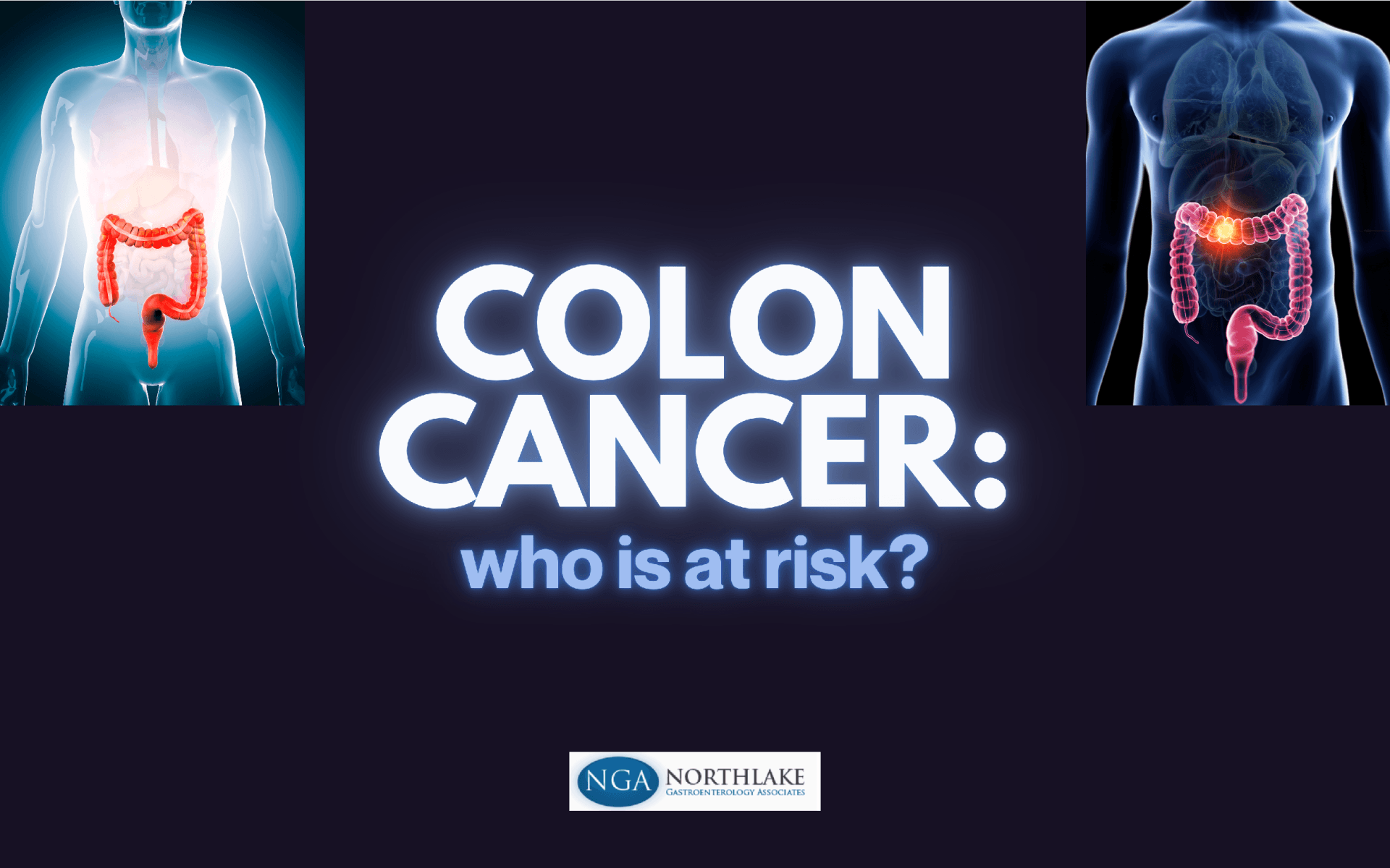 Colon Cancer Who is At Risk Graphic