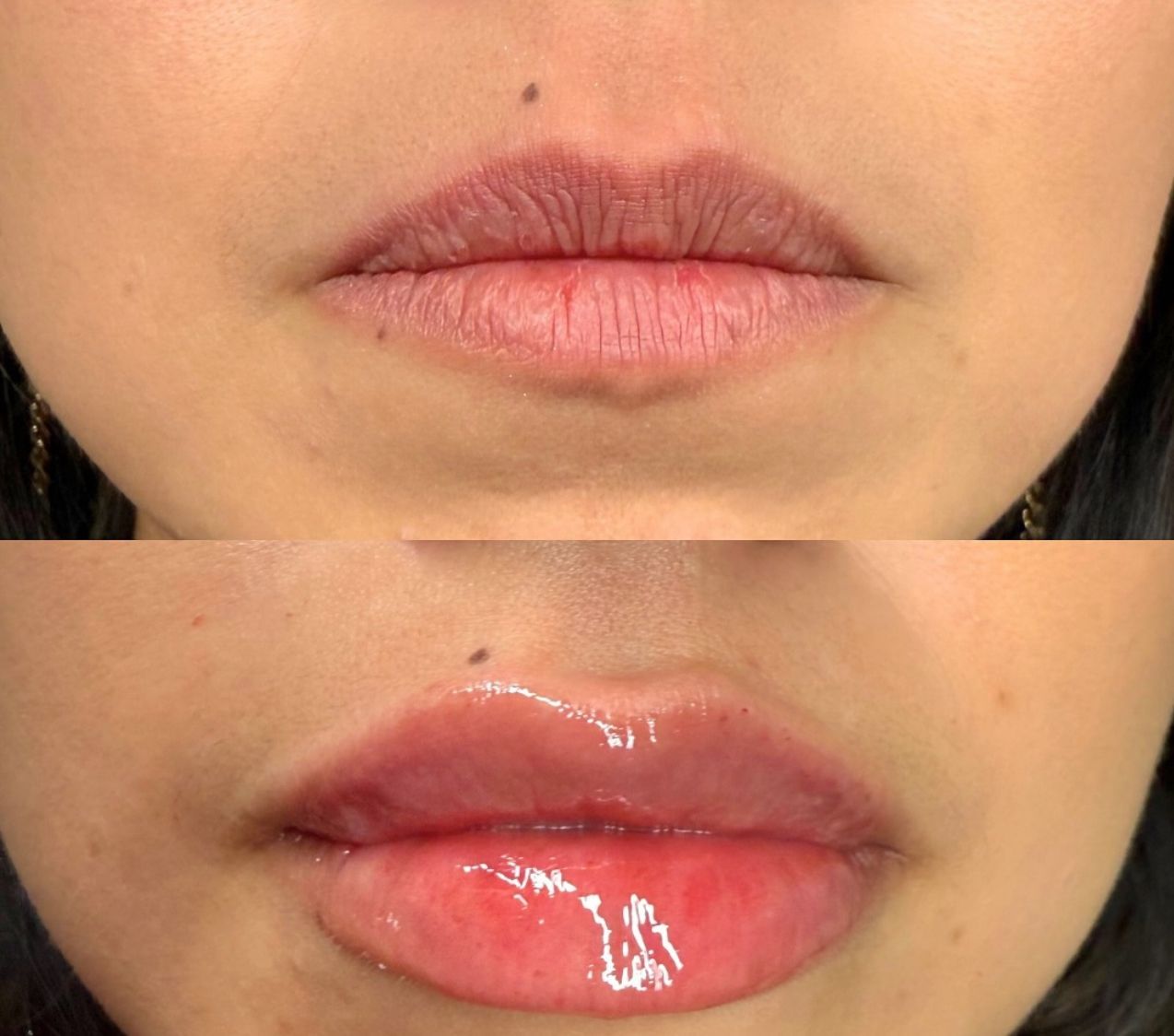 A before and after photo of a woman 's lips.