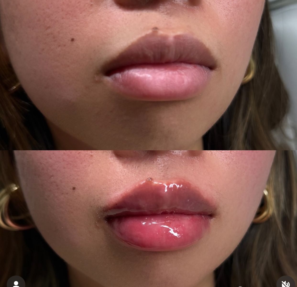 A close up of a woman 's lips with a before and after picture