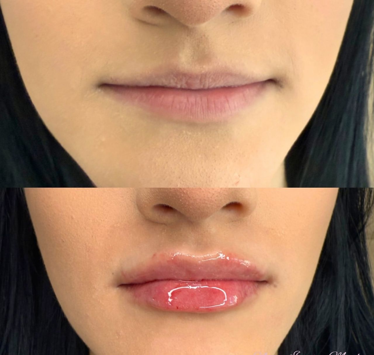 A before and after picture of a woman 's lips.