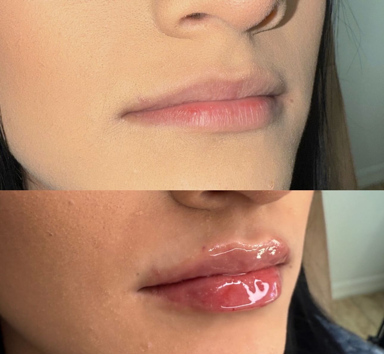 A before and after picture of a woman 's lips.