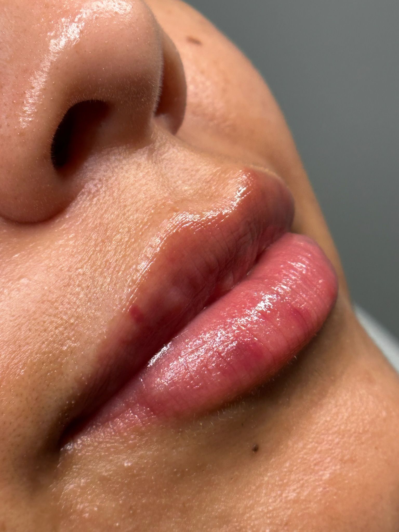 A close up of a woman 's lips and nose.