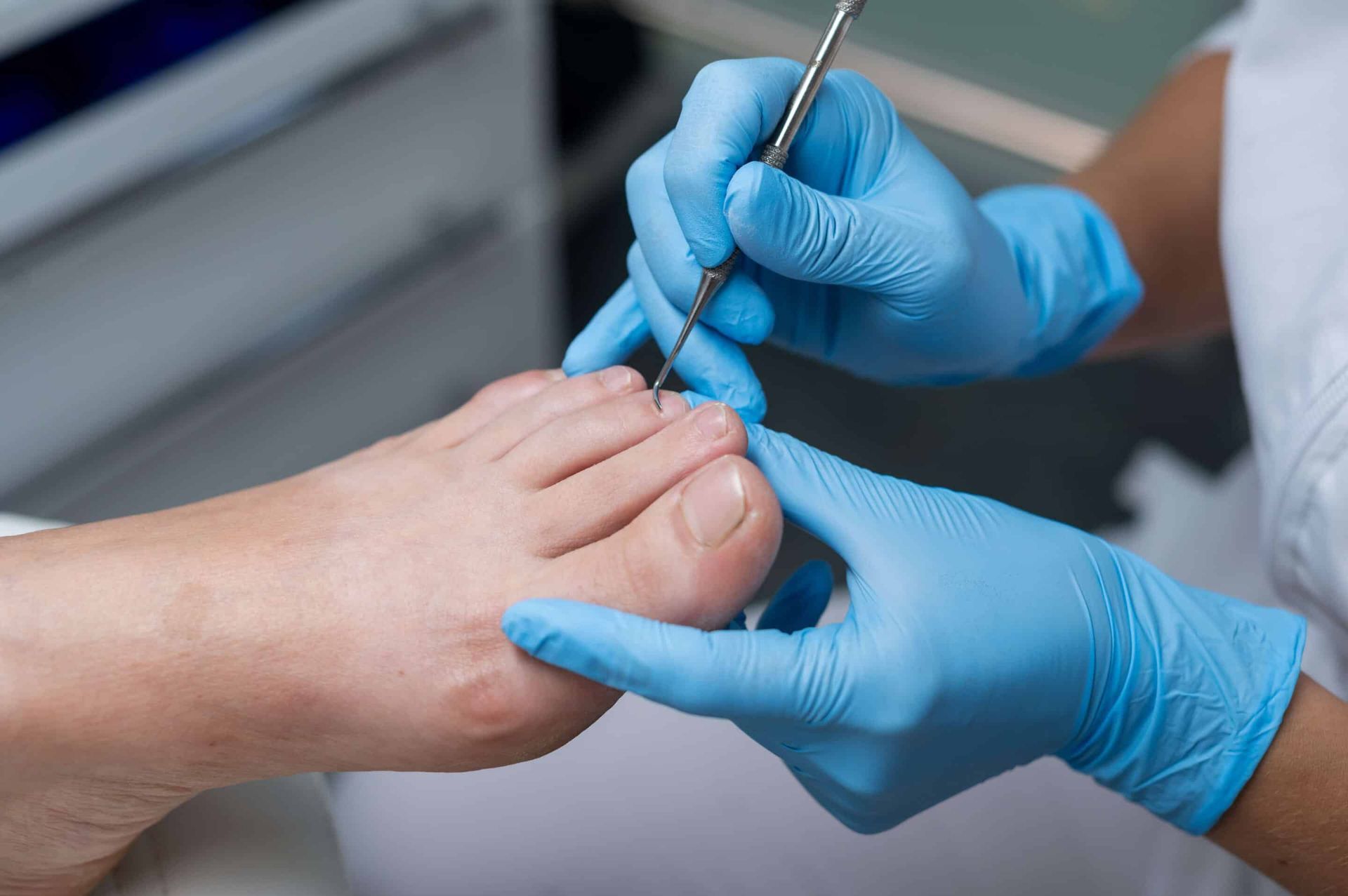Person's foot being examined; gloved hands use a tool to inspect toenail in a close-up setting.