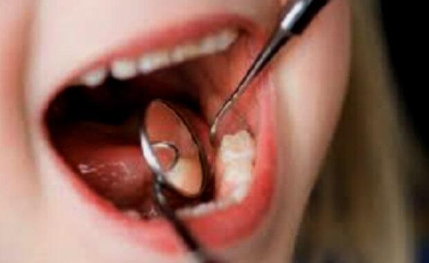 CLINICA DENTAL BIT - extracciones dentales