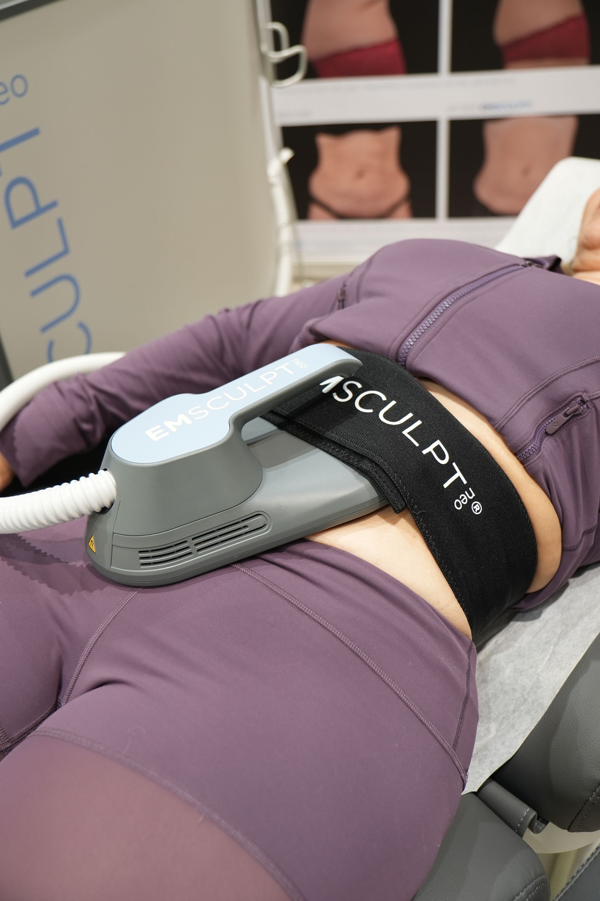 A woman is laying on a bed with a machine on her stomach.