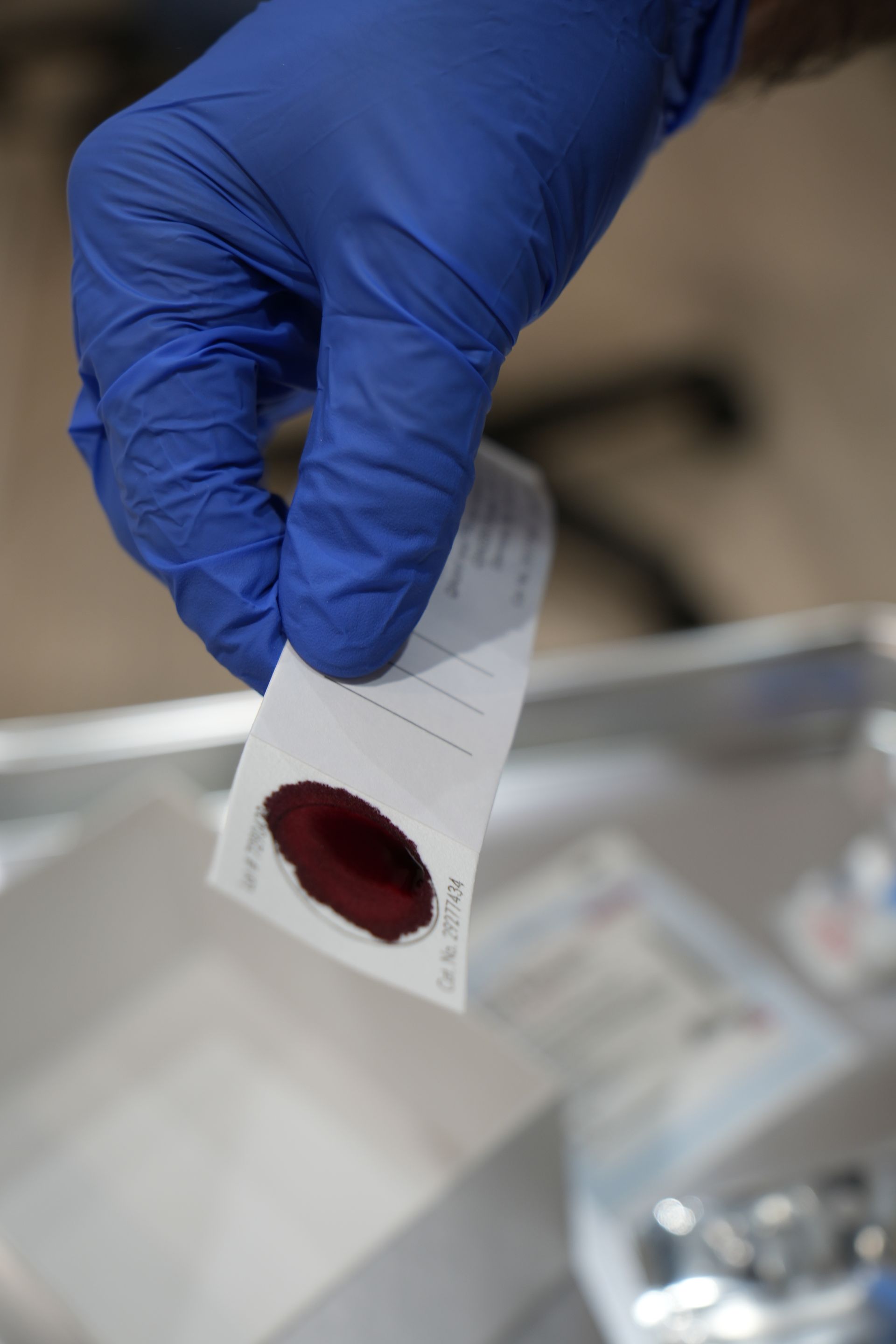 taking a blood sample for epigenetic testing