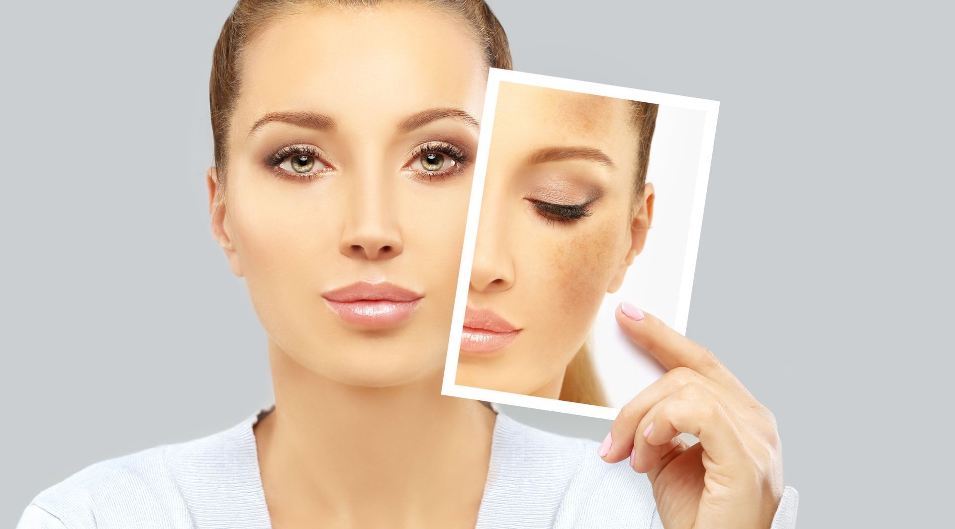 A woman is holding a picture of her face with and without freckles.