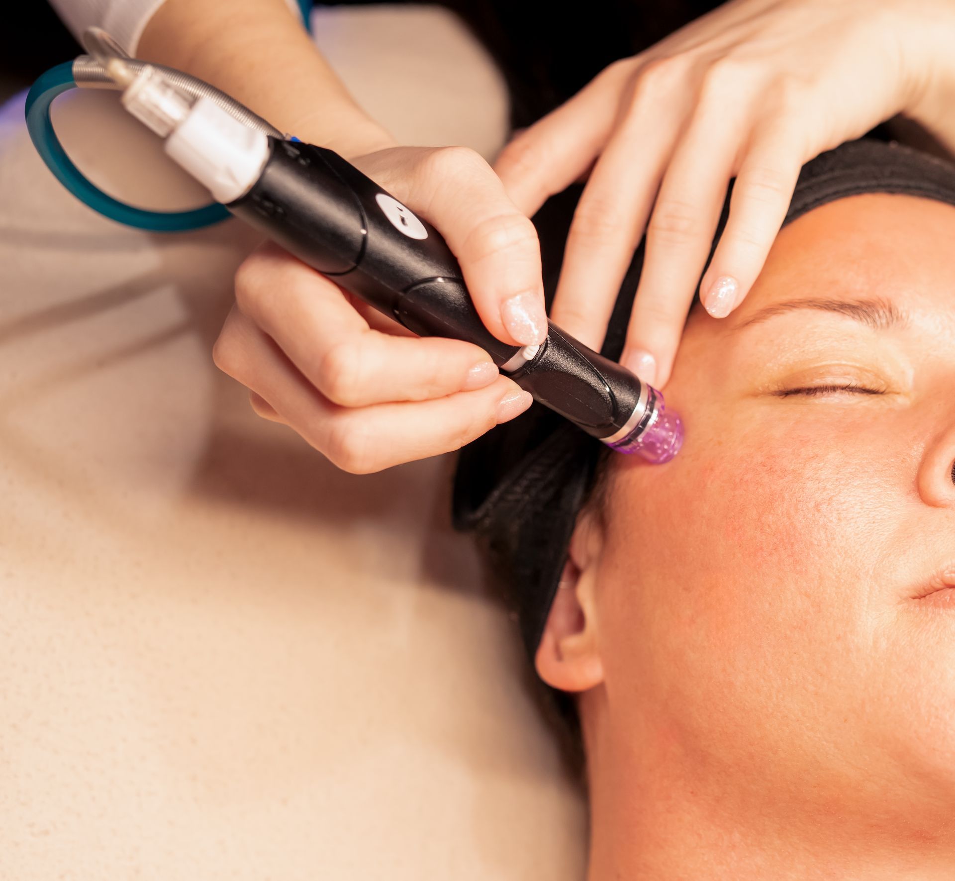 A before and after photo of a woman 's face with and without makeup.