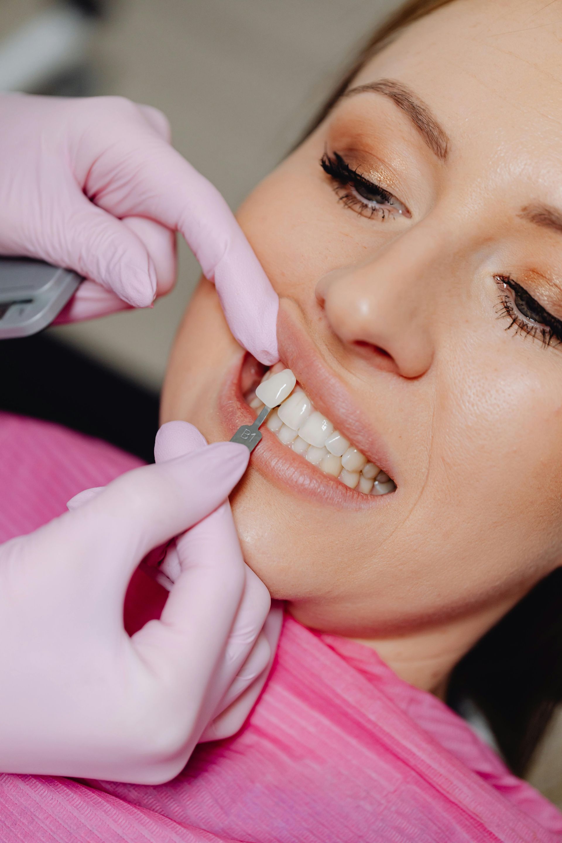 Dentist matching tooth shade with a shade guide on a woman in a dental chair.