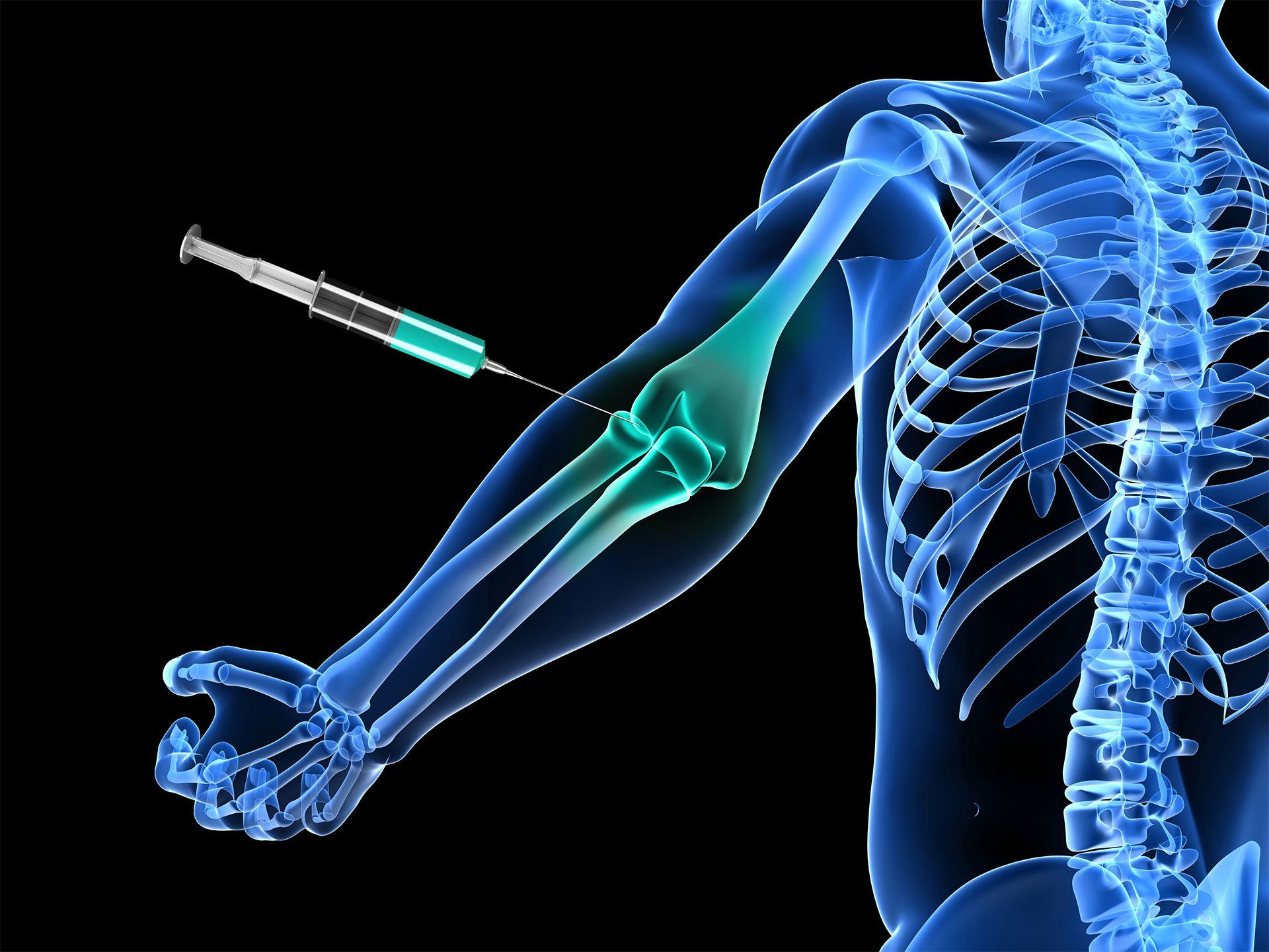 The Center for Spine & Sport Medicine | Fluoroscopic Guided Injections | Huntington Station, NY | Astoria, NY