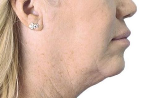 A close up of a woman 's face with earrings on.