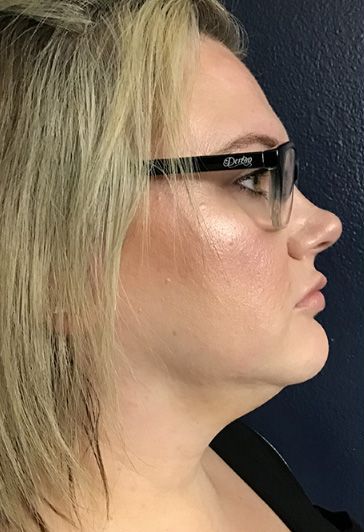 A close up of a woman 's face wearing glasses.