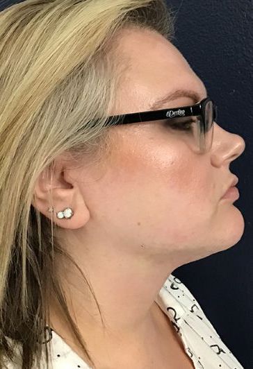 A close up of a woman wearing glasses and earrings.