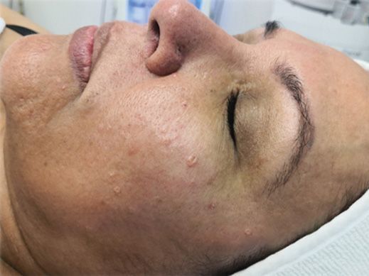 A close up of a woman 's face with her eyes closed.