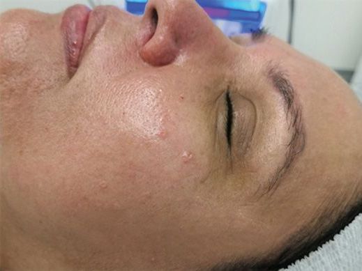 A close up of a woman 's face with her eyes closed.