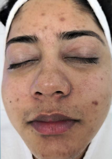 A close up of a woman 's face with her eyes closed