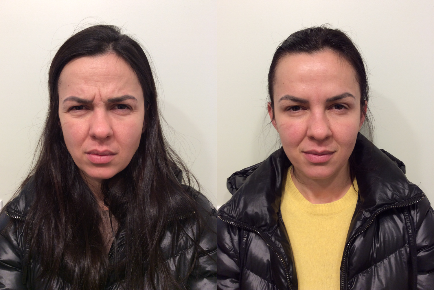 20 units in 11’s/brows