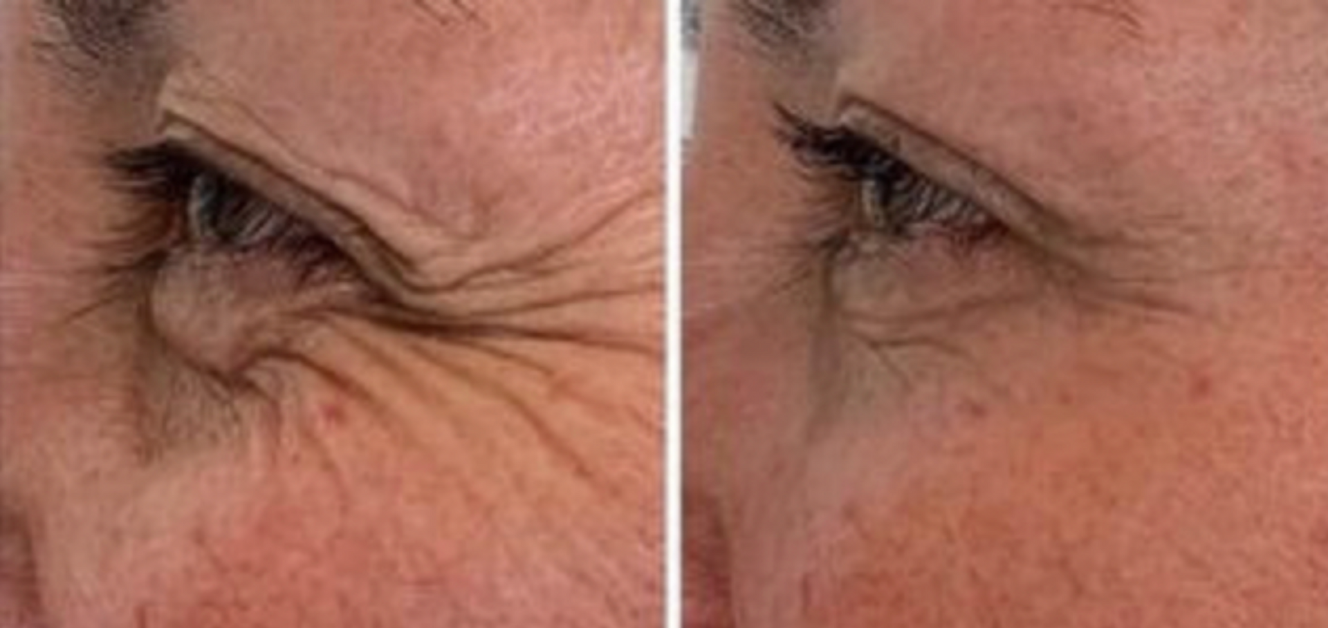 Plasmage for Dynamic Wrinkles