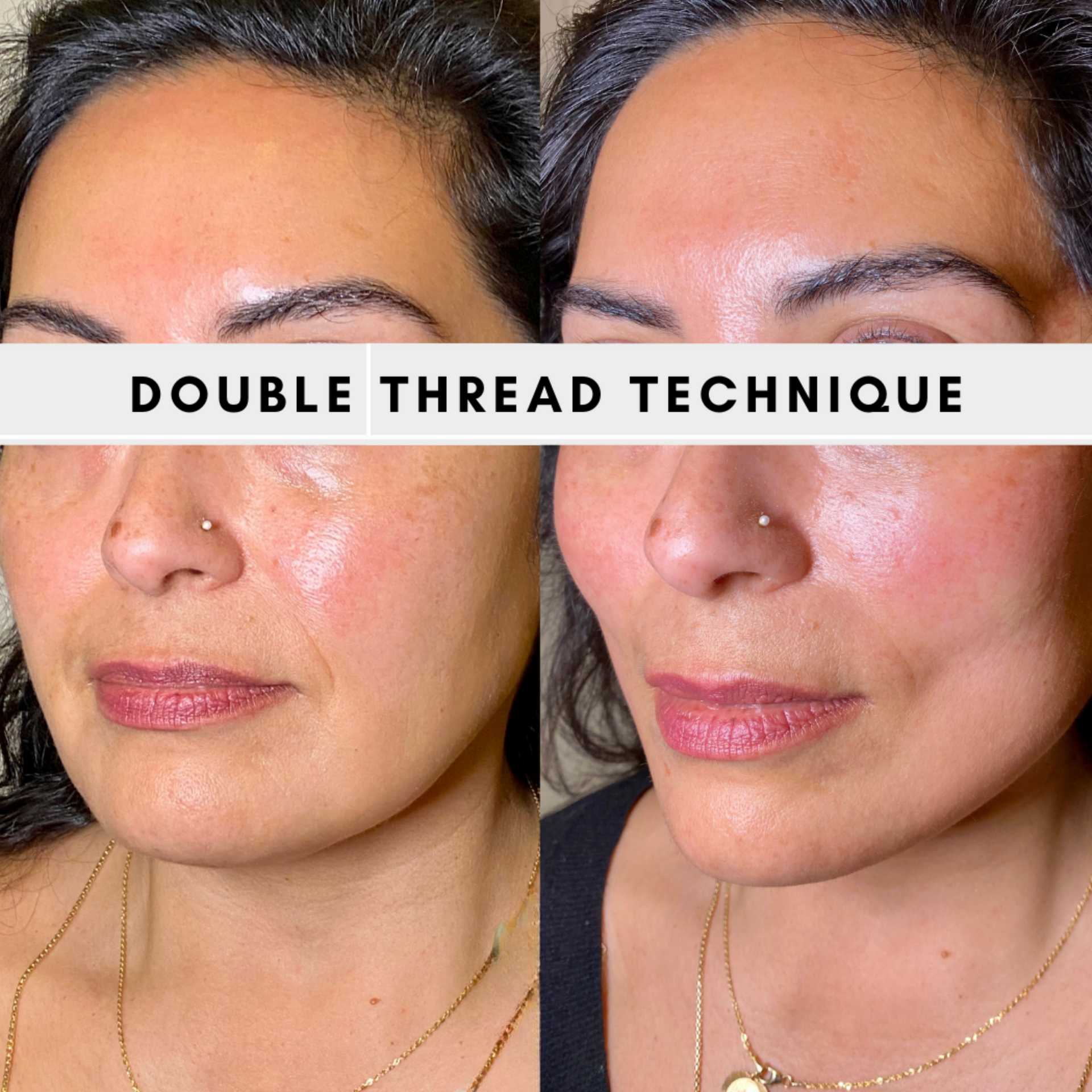 PDO Thread before and after of a woman's face