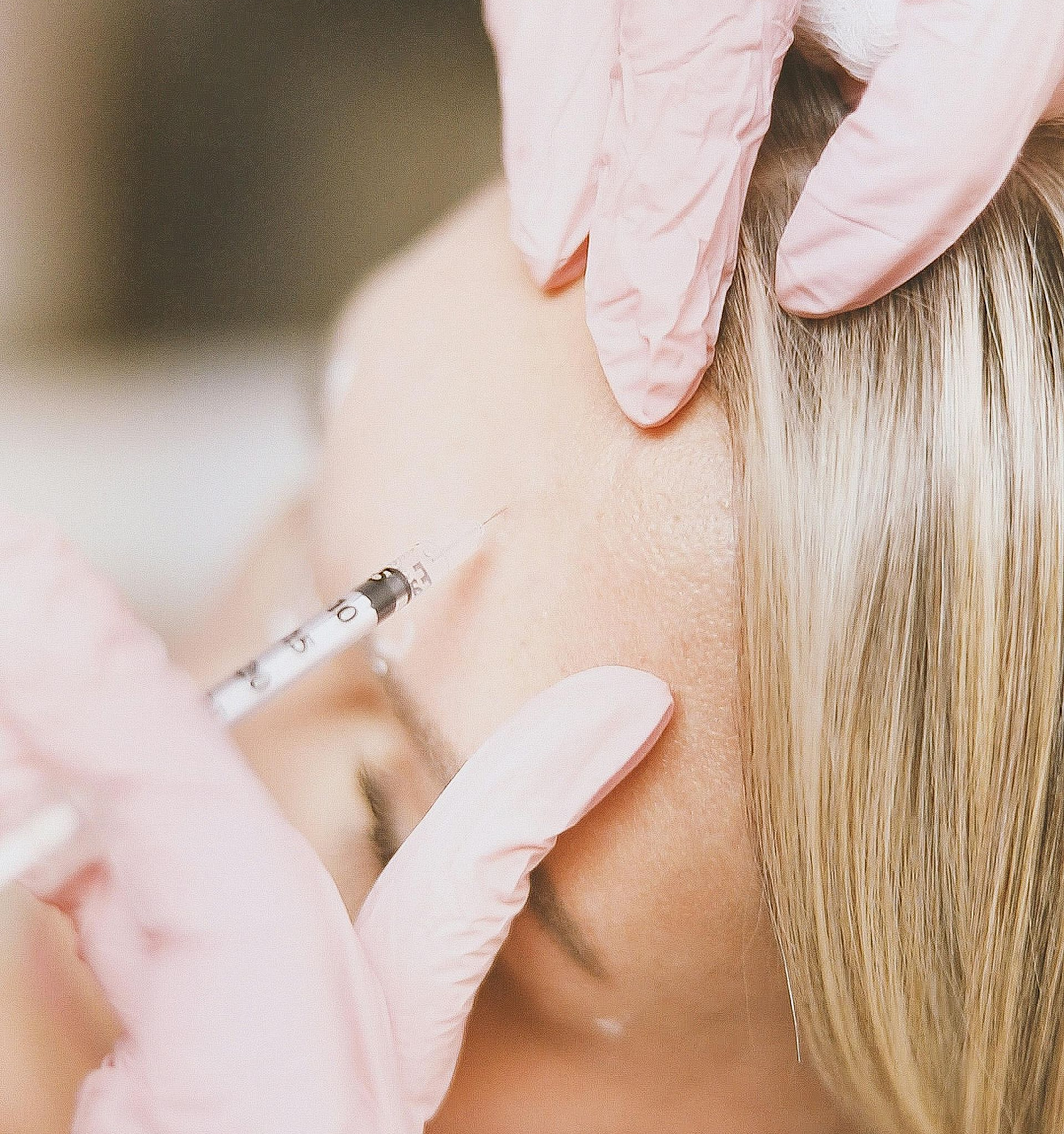 Dermal Filler Treatment