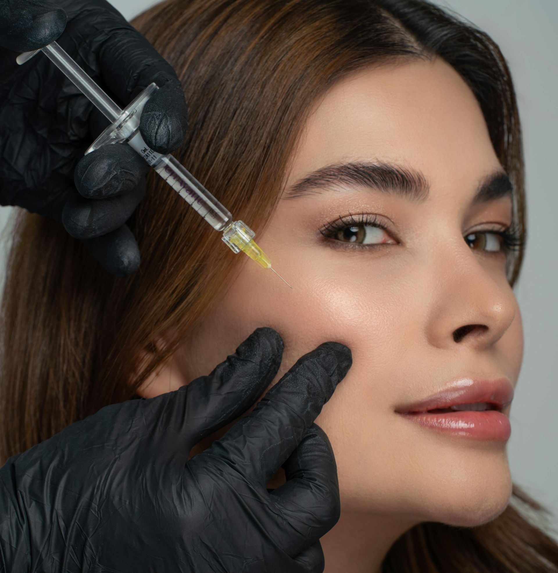 Dermal Filler Treatment