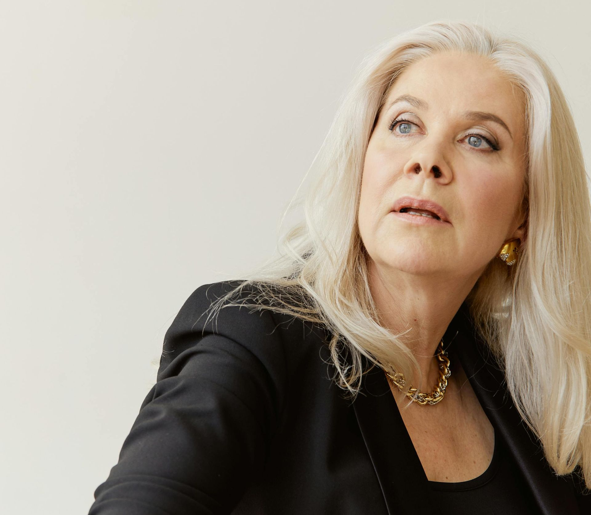 Dermal Filler Treatment