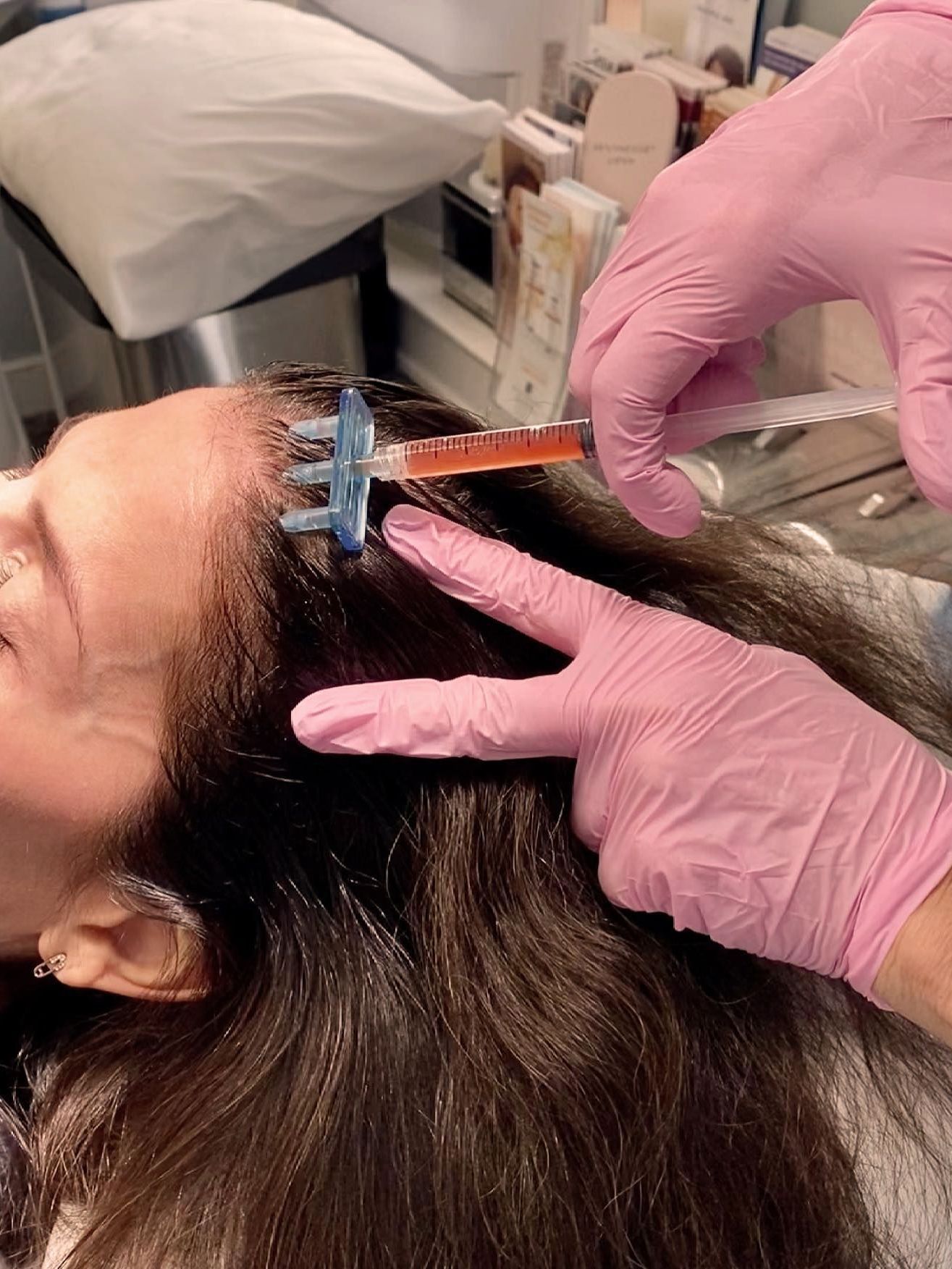 Hair growth treatment by Lisa Topham, RN