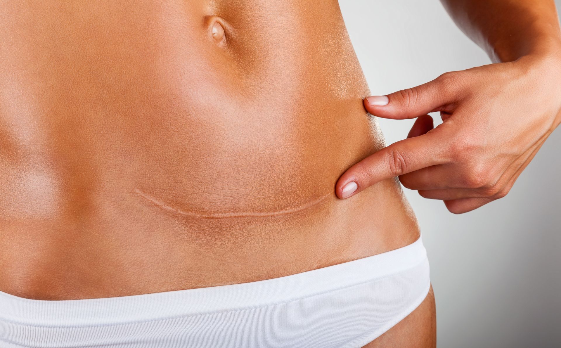 Nahaufnahme eines durchtrainierten Bauches, während eine Hand die Haut in der Nähe der Taille kneift.