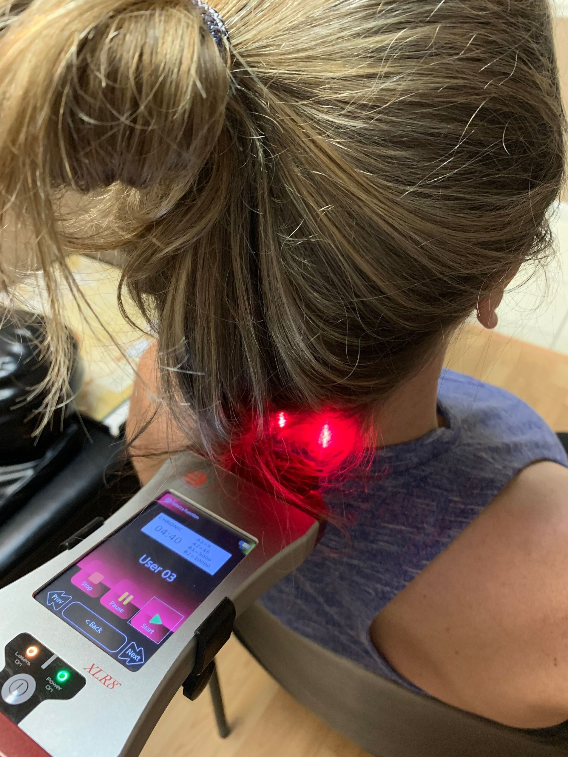 Cold Laser Therapy — Saint Petersburg, FL — Miller Chiropractic & Wellness Cold Laser Therapy — Saint Petersburg, FL — Miller Chiropractic & Wellness