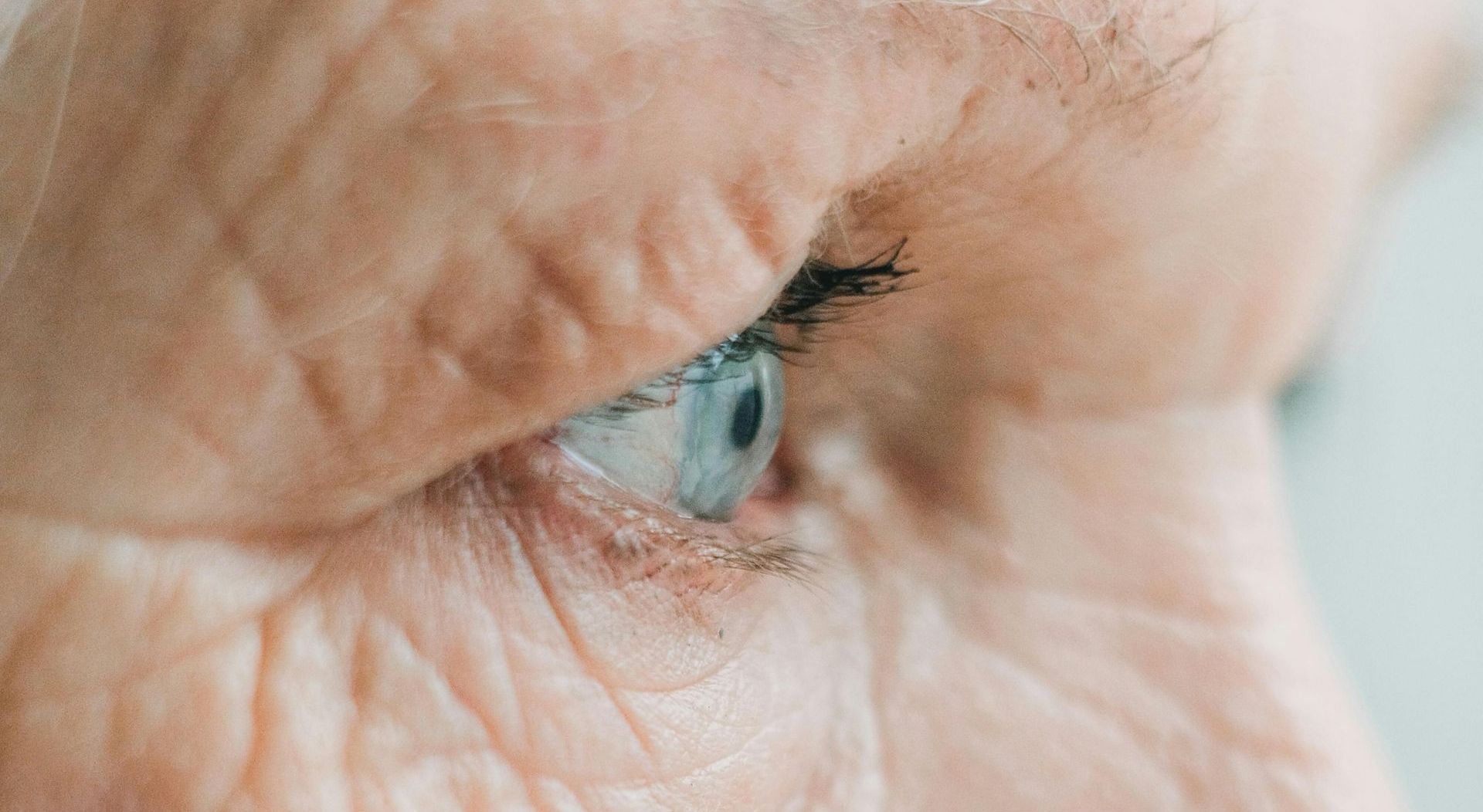 Facial Rejuvenation Treatment, Cornwall, Elapromode advanced European system for skin