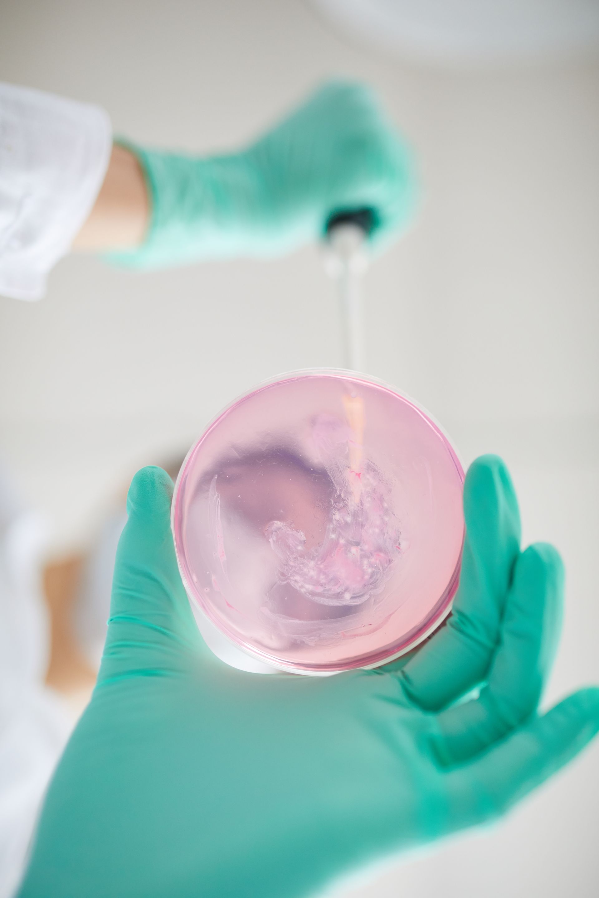 a person wearing green gloves is holding a petri dish with a dropper in it .